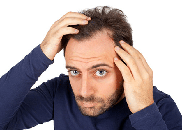ゴリラクリニックの毛髪再生治療は発毛に効果あり？料金設定はどれくらい？